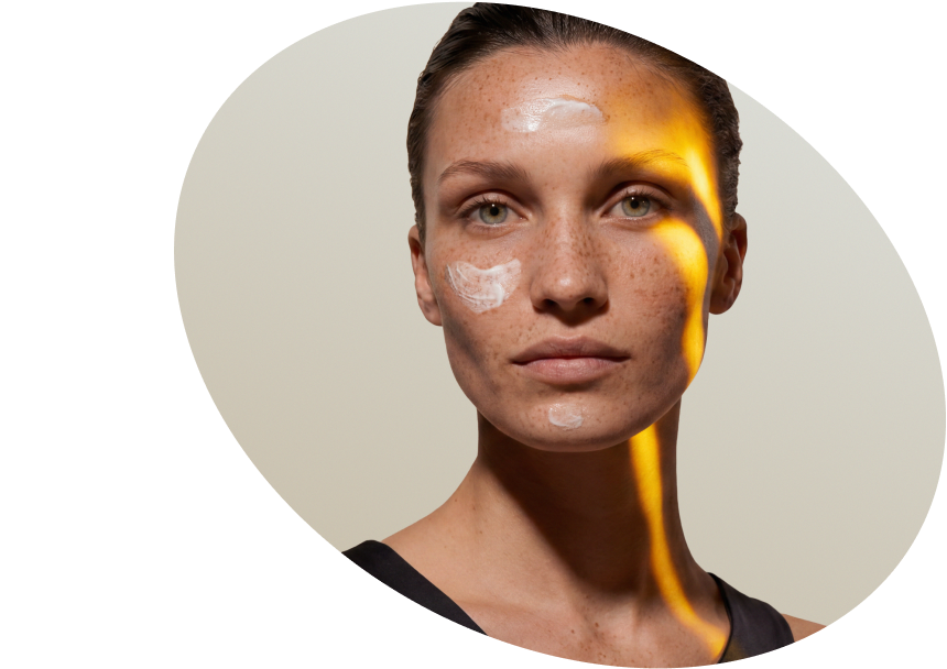Manchas  Oscuras  e Hiperpigmentación  Facial  - Compre  Productos  Iluminadores  Colombia