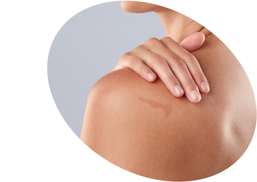 Dark Spots &amp; Body Hyperpigmentation - Shop Brightening Products Azerbaijan