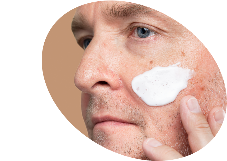 Actinic Keratosis Sunscreens - Shop Very High Protection SPF India