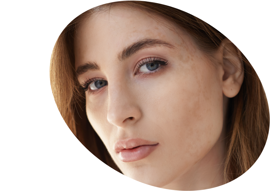 Dark Spots Sunscreen - Shop High Protection SPF for Dark Spots Austria