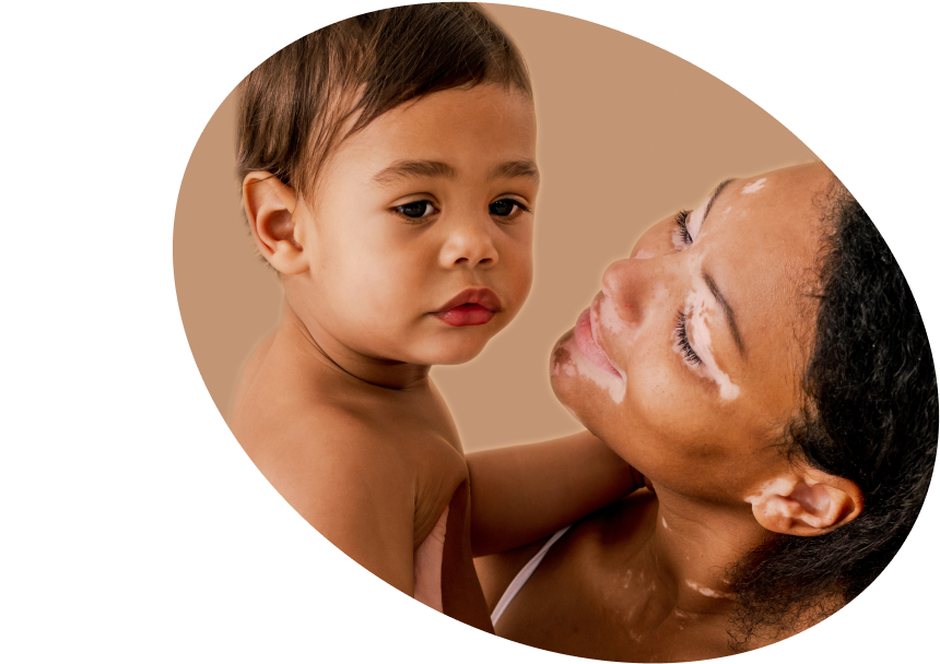 Moms - Shop Body Care for Pregnancy &amp; Postpartum Italy