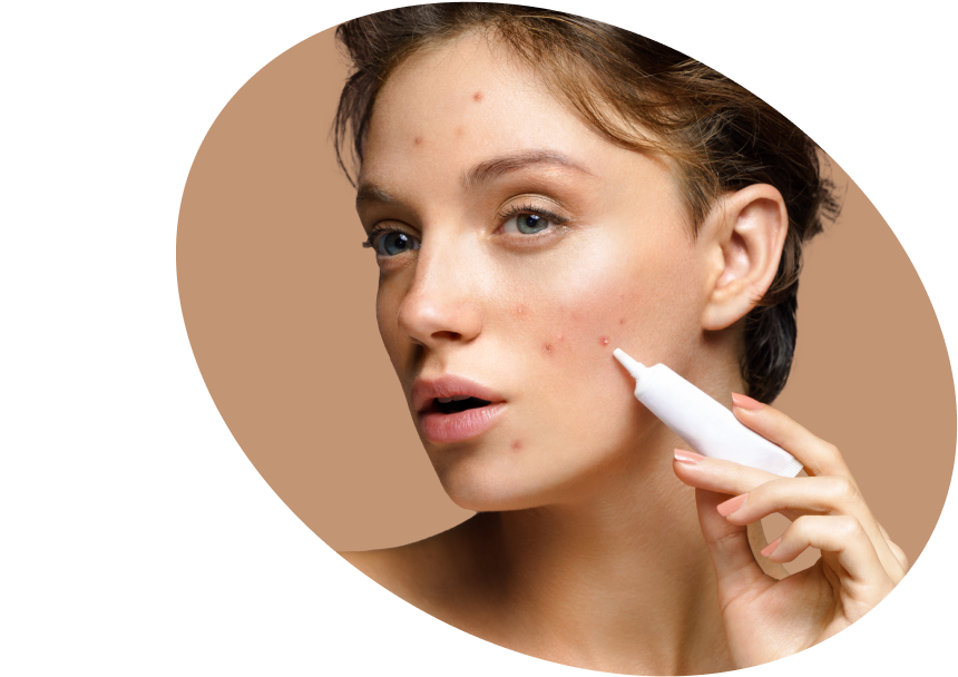 Ácido  Salicílico  - Compre  Skin  Care  con BHA México