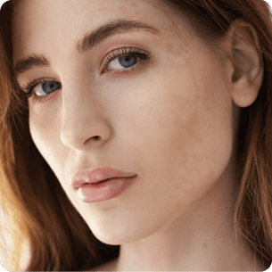 Dark Spots Sunscreen