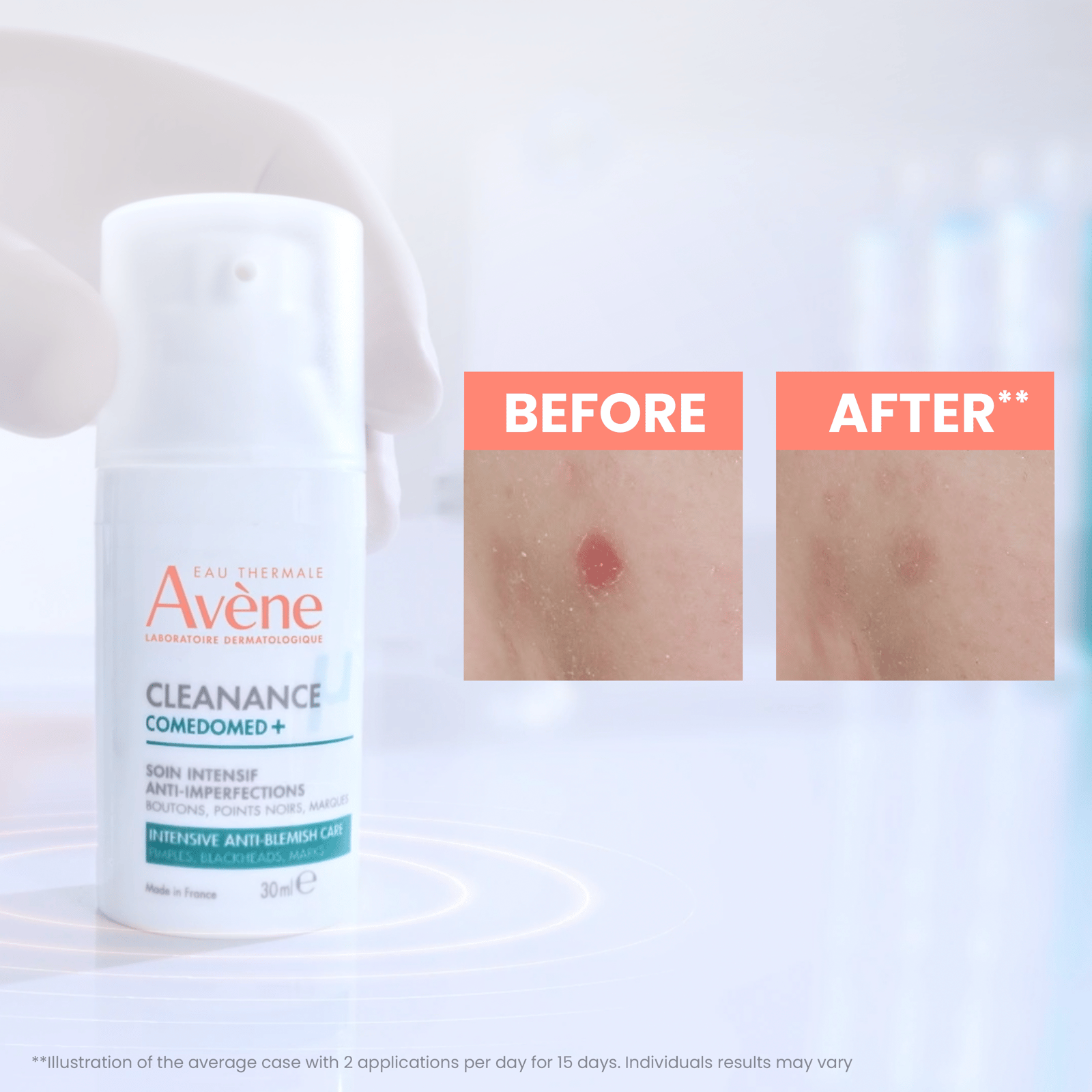 Avène Cleanance Comedomed+ Cuidado Intensivo Antiimperfecciones 30ml