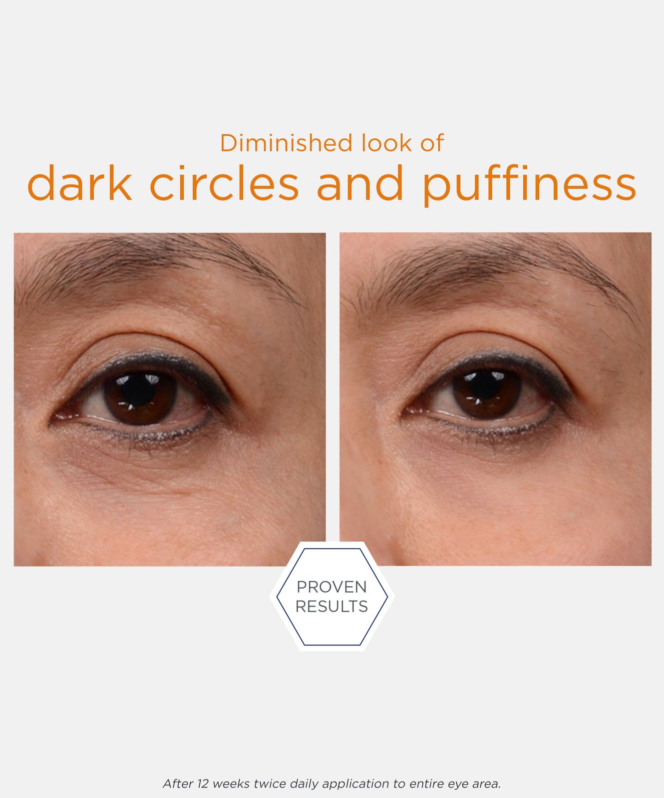 Neostrata Enlighten Creme de Olhos Iluminador 15g