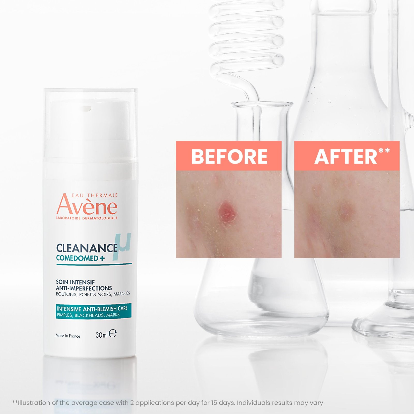 Avène Cleanance Comedomed+ Anti-Imperfections Intensive Anti-Blemish Care 30ml