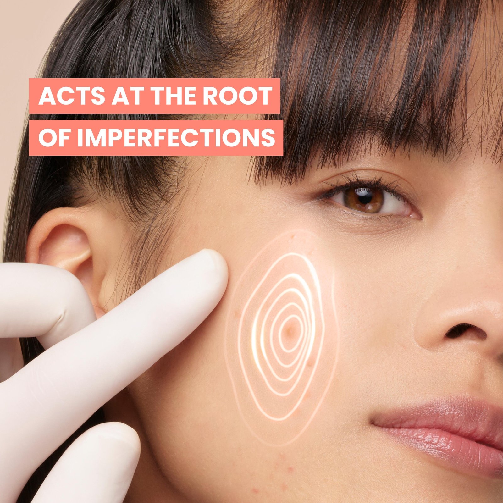 Avène Cleanance Comedomed+ Anti-Imperfections Intensive Anti-Blemish Care 30ml