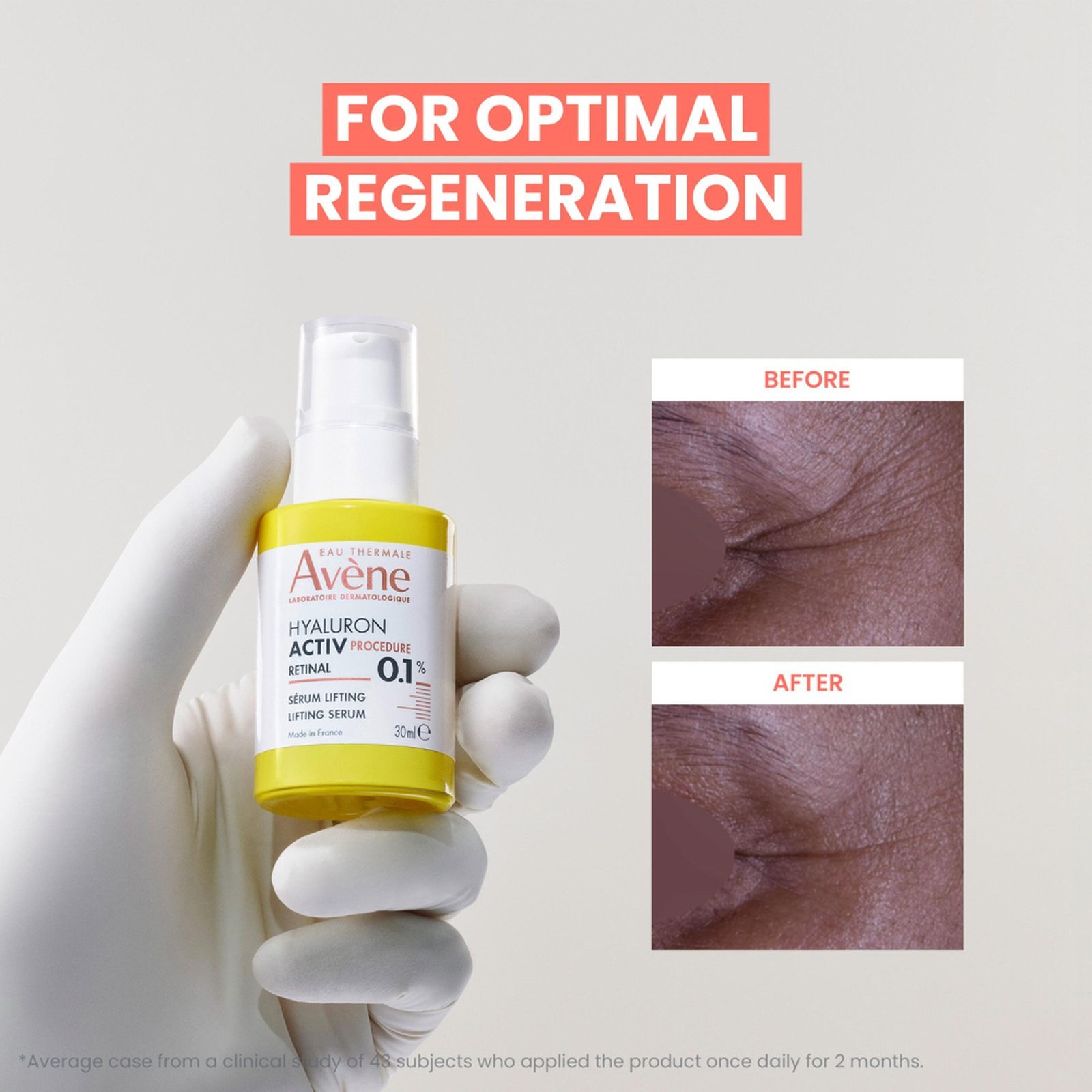 Avène Hyaluron Activ Procedure Lifting Serum 30ml