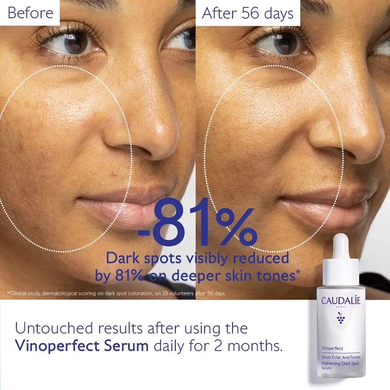 Caudalie Vinoperfect Brightening Dark Spot Serum 50ml