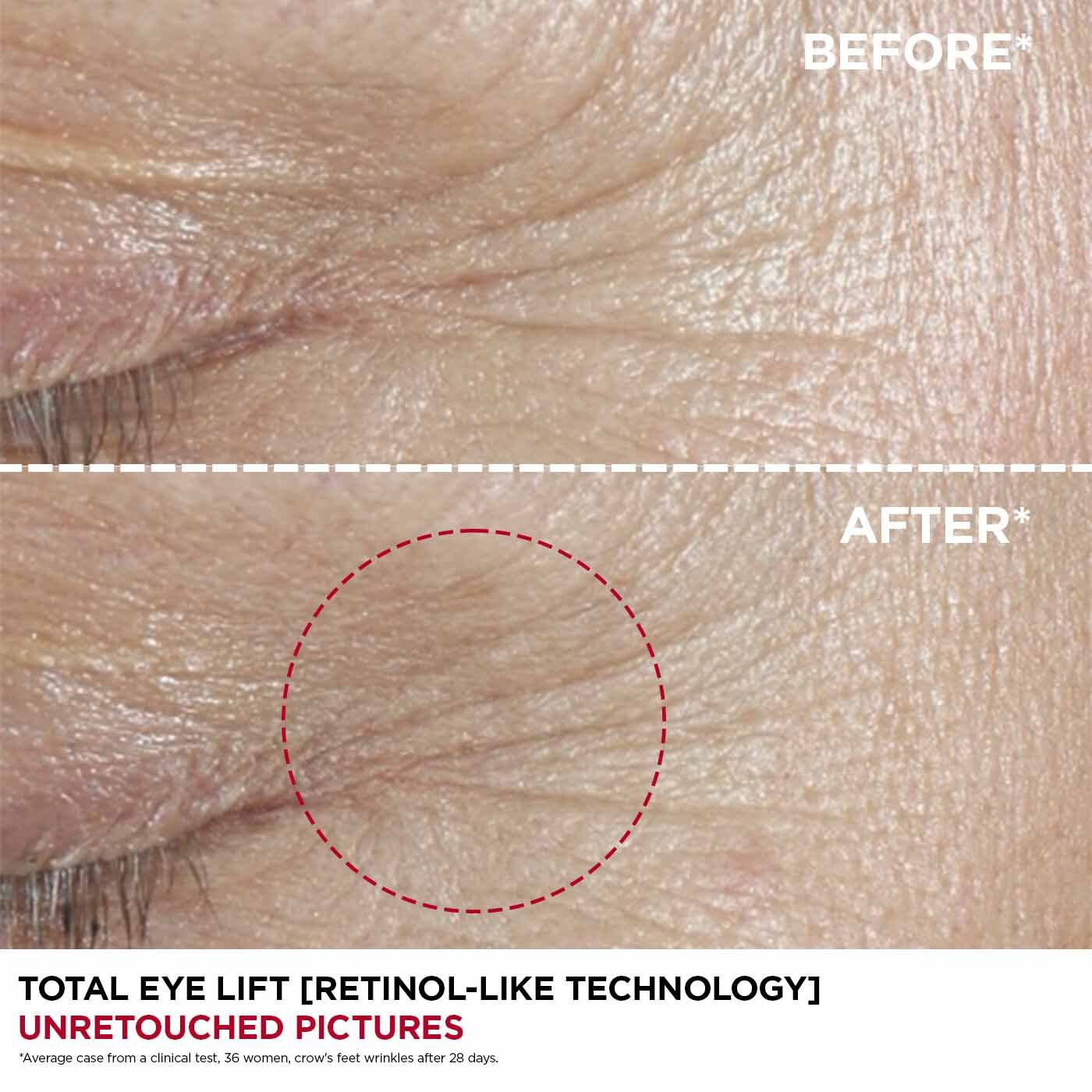 Clarins Concentrado Lifting Total para Ojos