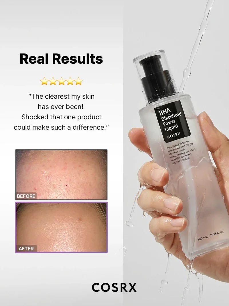 COSRX BHA Blackhead Power Liquid 100ml (3.38floz)