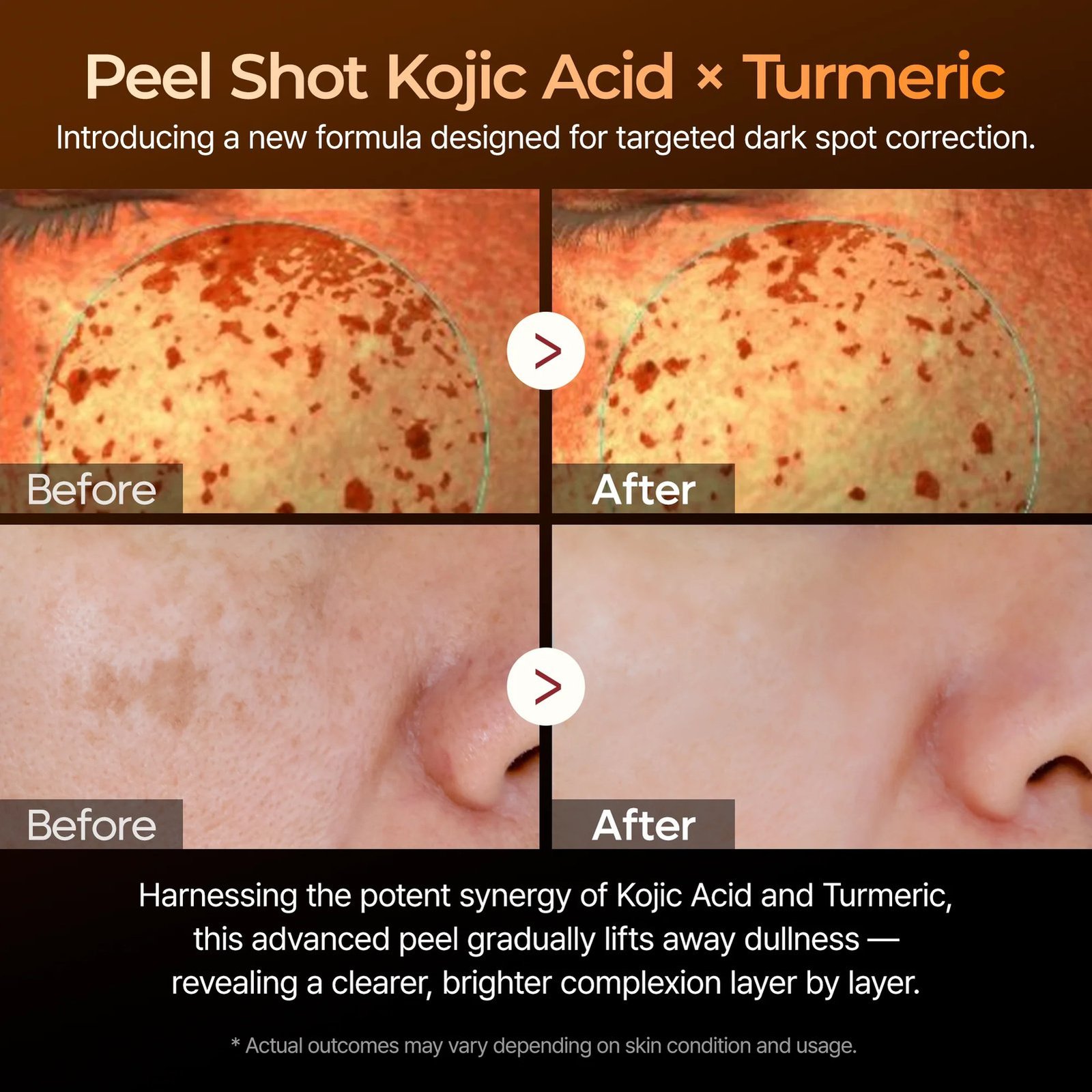 Dr.Melaxin Peel Shot Exfoliating Kojic Acid Turmeric Serum 80ml