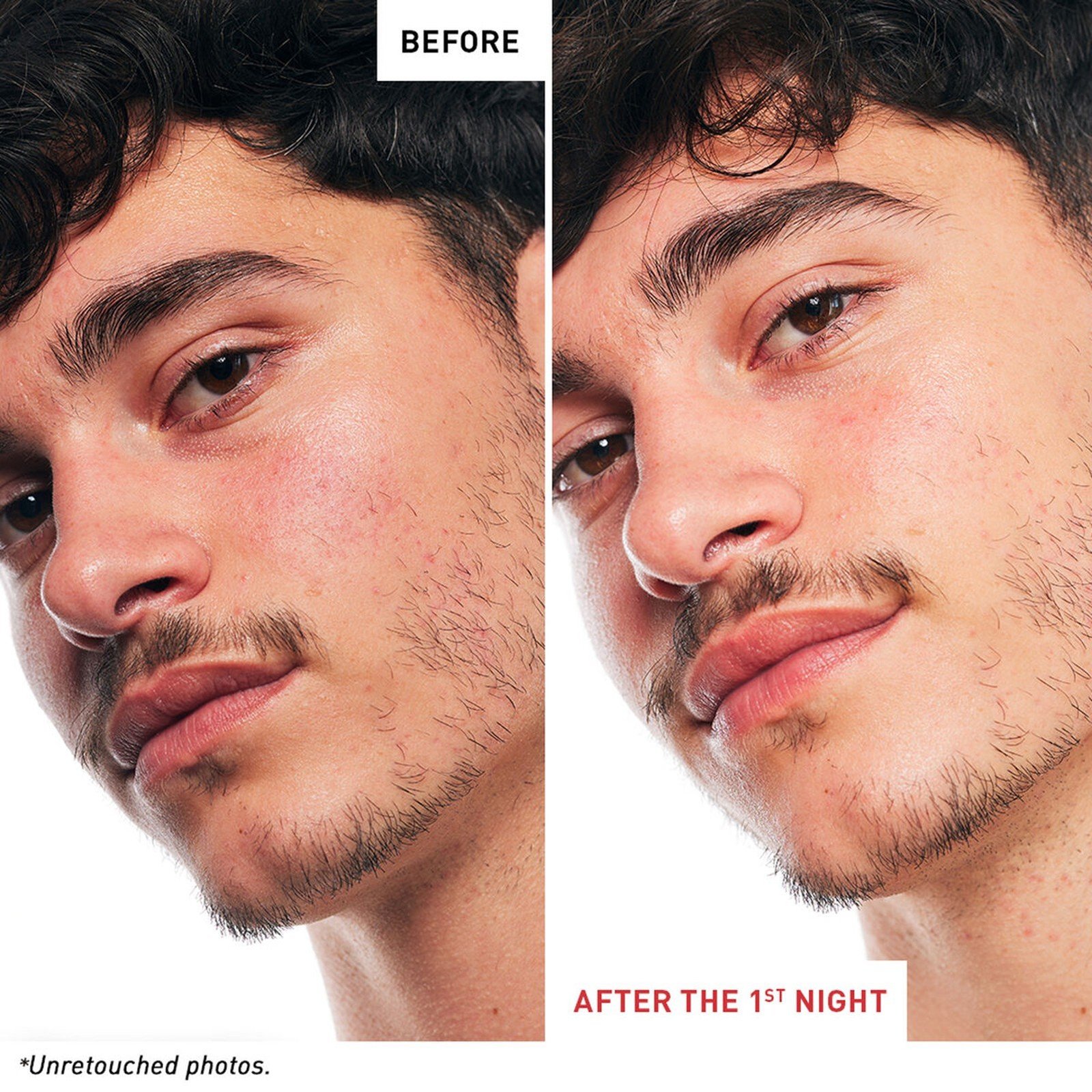 Erborian Skin Therapy Multi-Perfecting Night Oil 30ml (1floz)