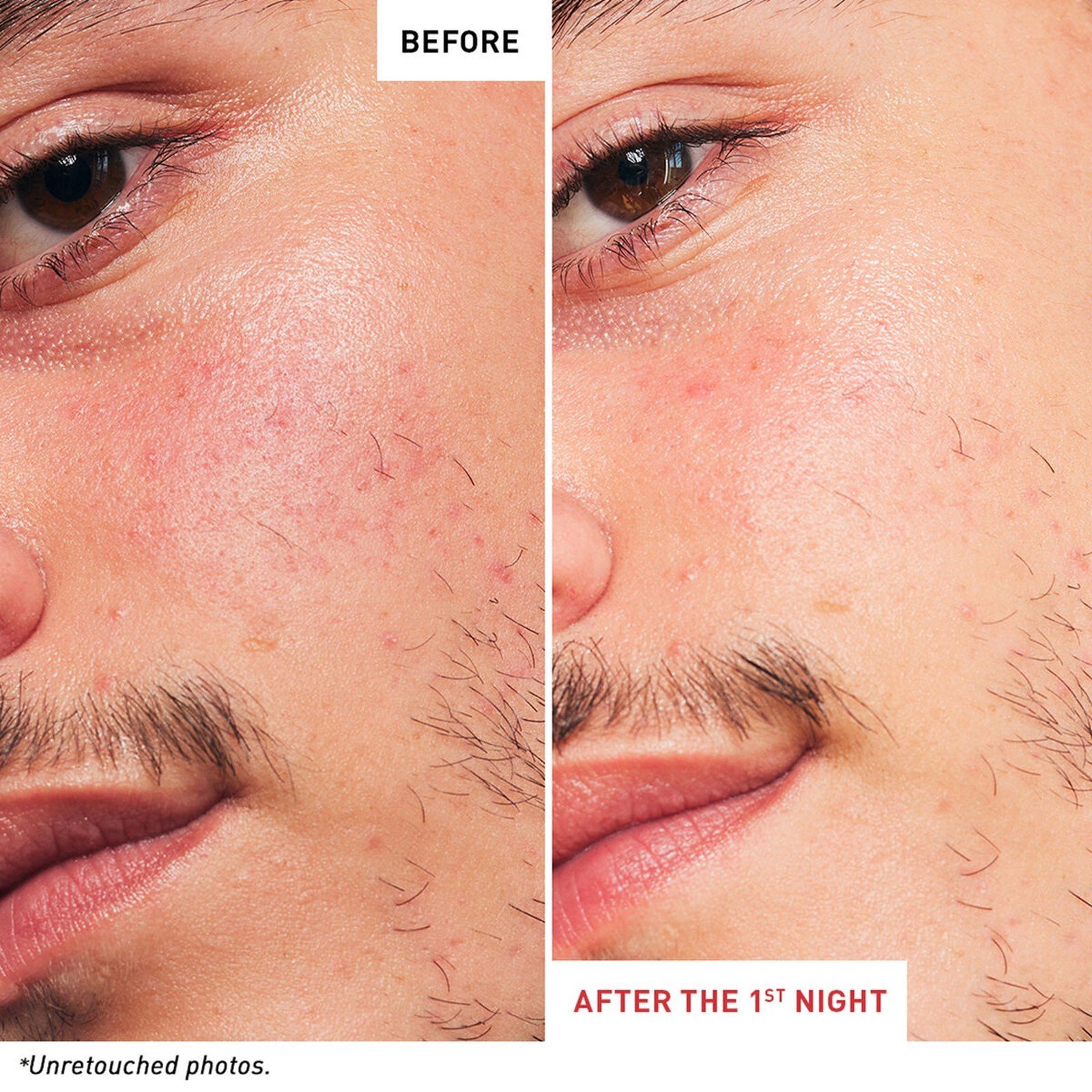Erborian Skin Therapy Multi-Perfecting Night Oil 30ml (1floz)
