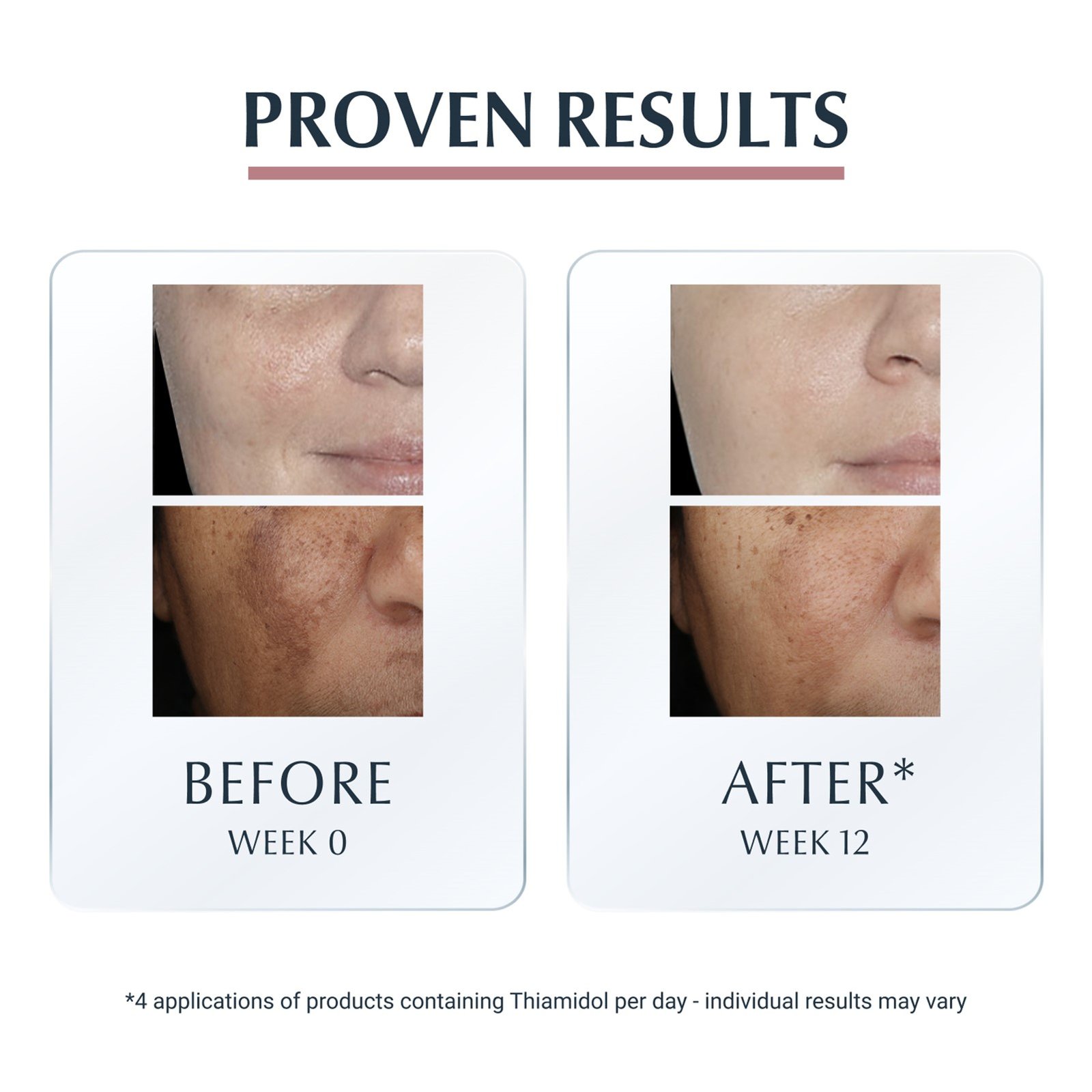 Eucerin Anti-Pigment Corretor Localizado Manchas Escuras 5ml