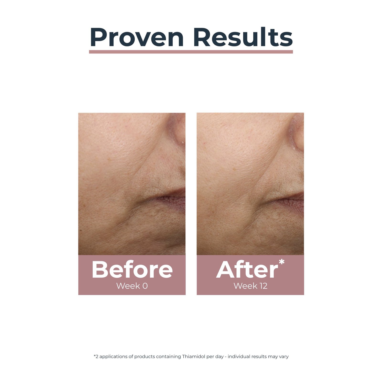 Eucerin Anti-Pigment Tinted Day Cream SPF30 Medium Dark Spots 50ml