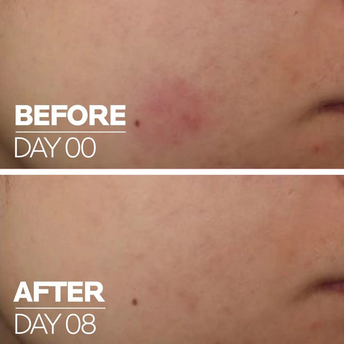 La Roche-Posay Cicaplast B5 Sérum Ultra-Hidratante 30ml