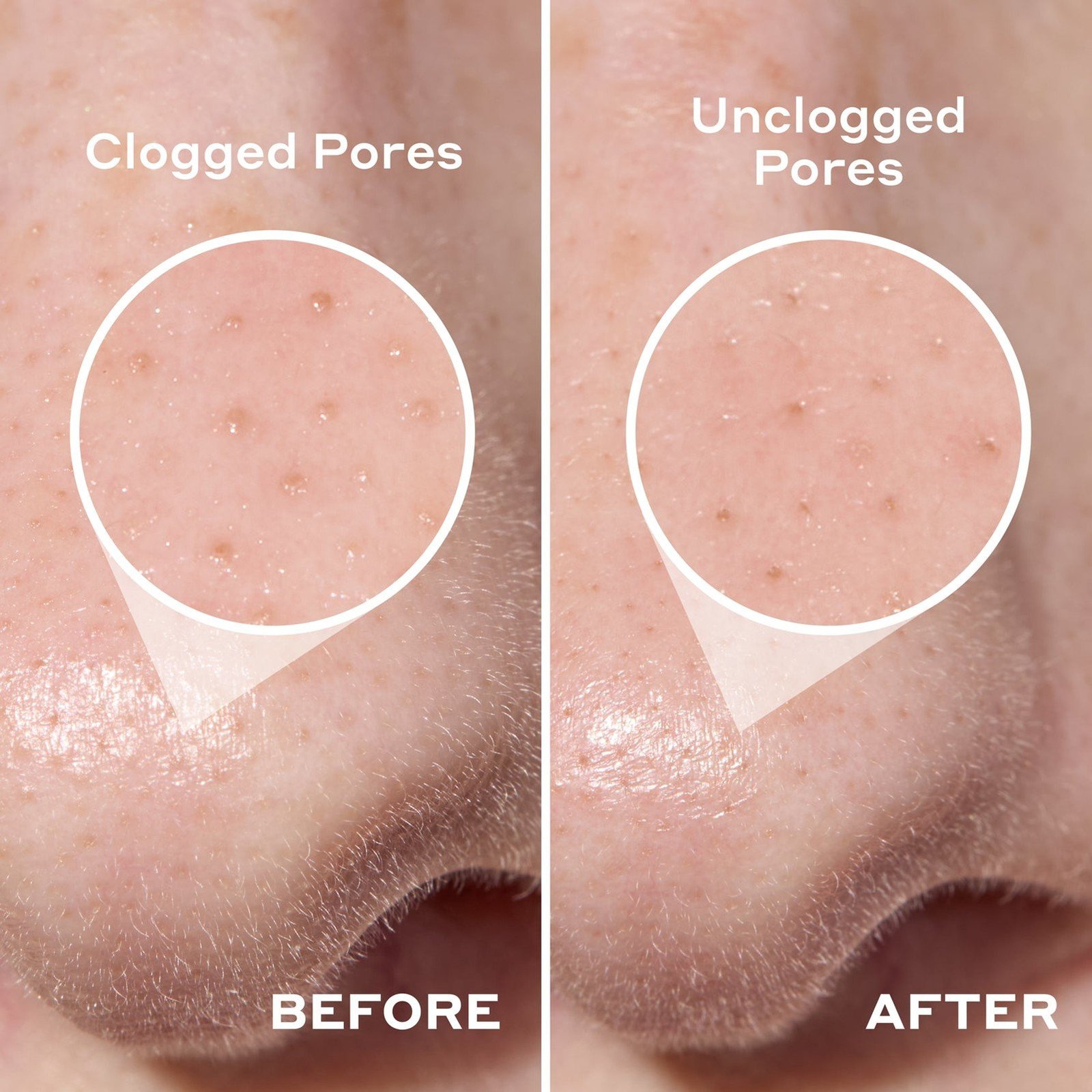 Mario Badescu 2-In-1 Deep Cleansing Pore Strip x6