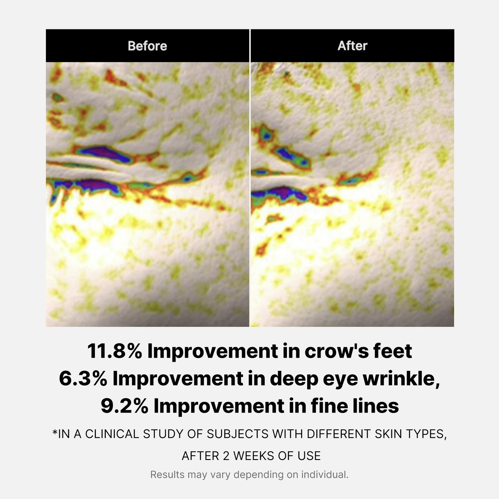 Medicube كريم العيون المرمم بالببتيدات Deep Lifting 30ml