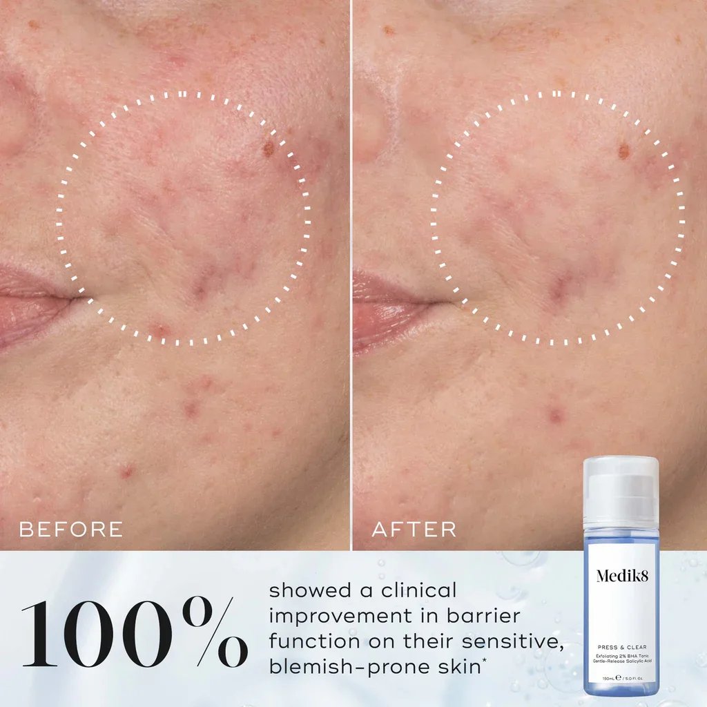 Medik8 Press & Clear Tónico Exfoliante 2% BHA 150ml