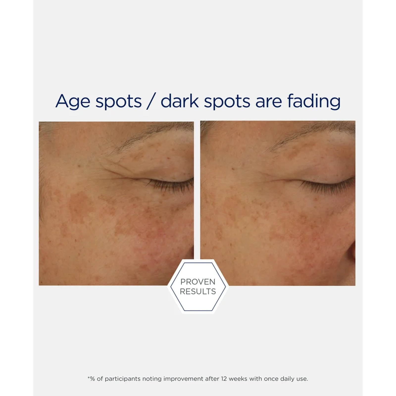 NeoStrata Skin Active Firming Potent Retinol Complex 30ml