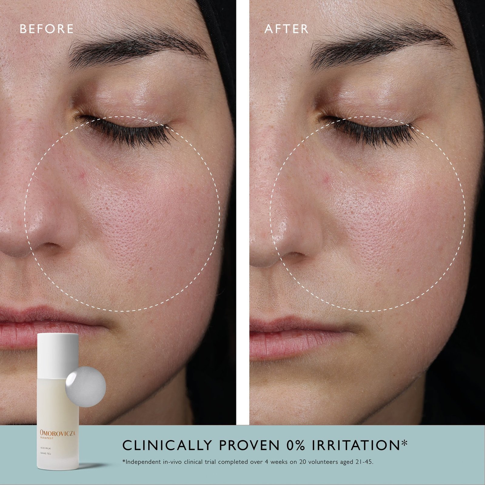 Omorovicza حليب الأحماض 100ml