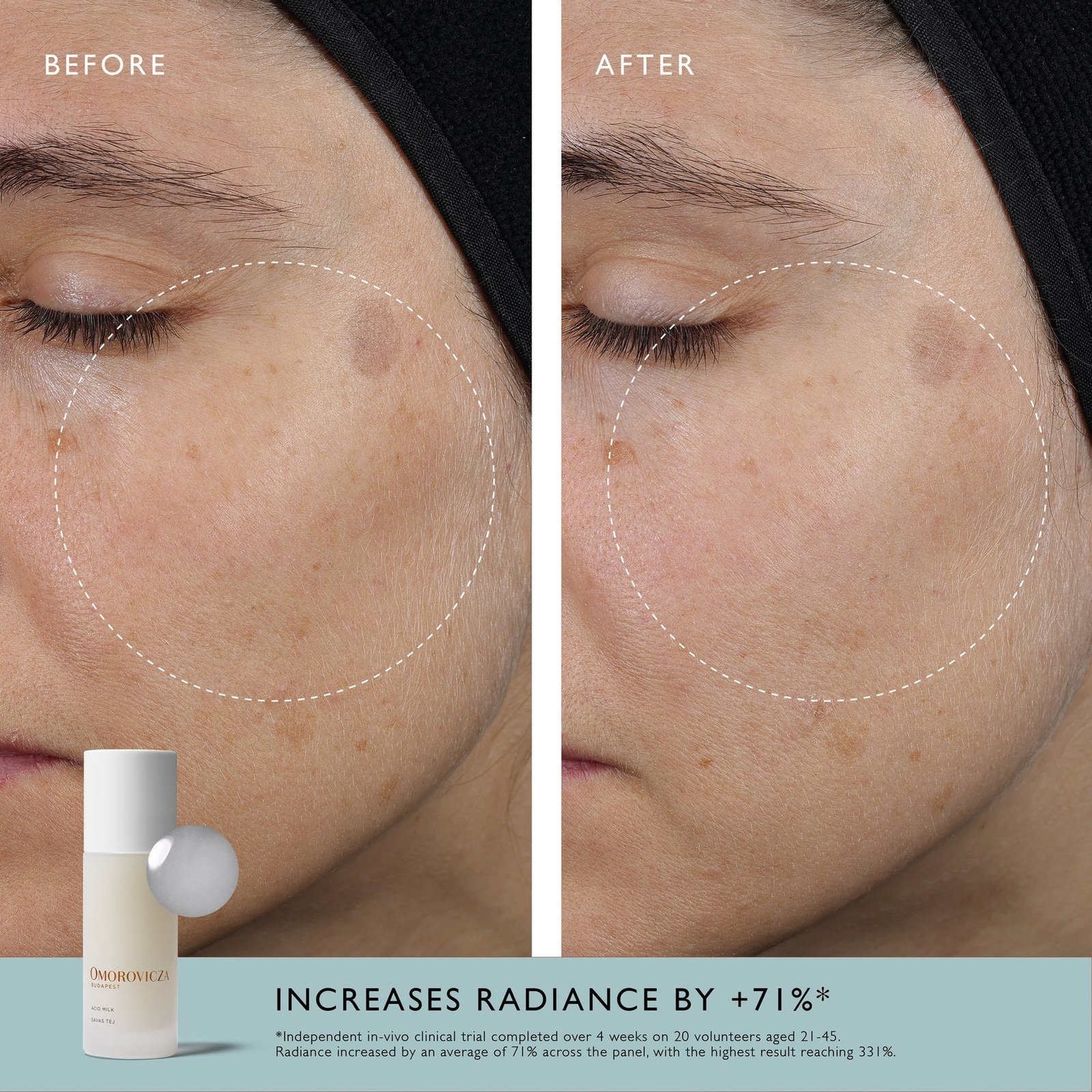 Omorovicza حليب الأحماض 100ml