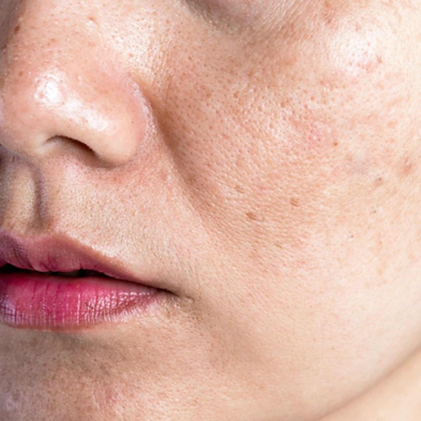 RVB LAB Meso Fill Micro-Peel Tri-Ácido Exfoliante e Iluminador 50ml