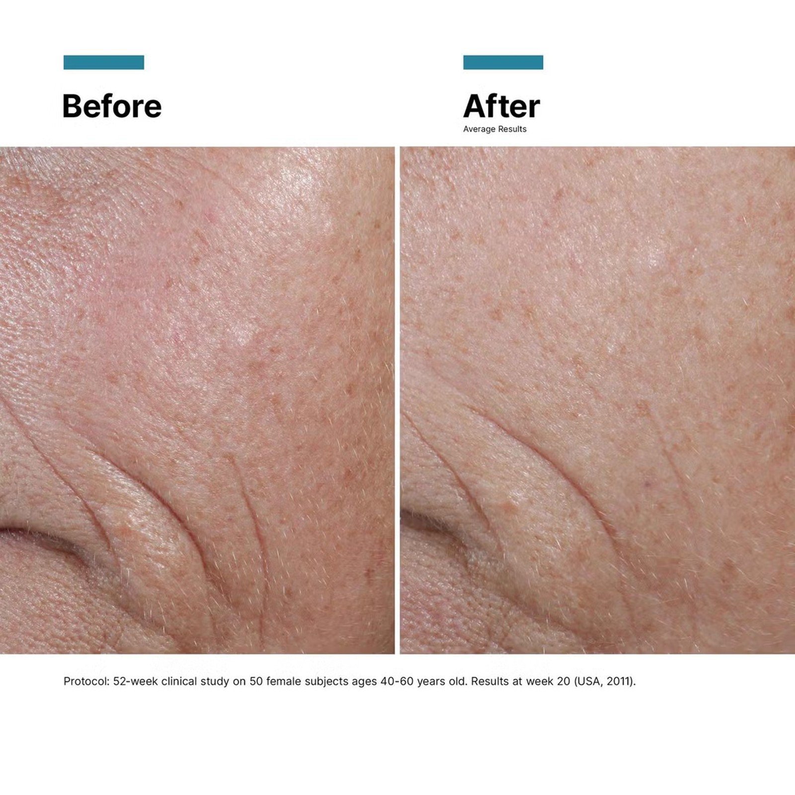 SkinCeuticals Prevent C E Ferulic 30ml (1.01fl oz)