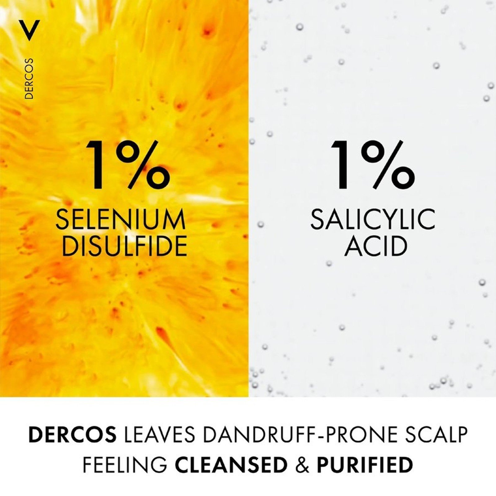 Vichy Dercos Champú Anticaspa DS para Cabello Normal a Graso 390ml