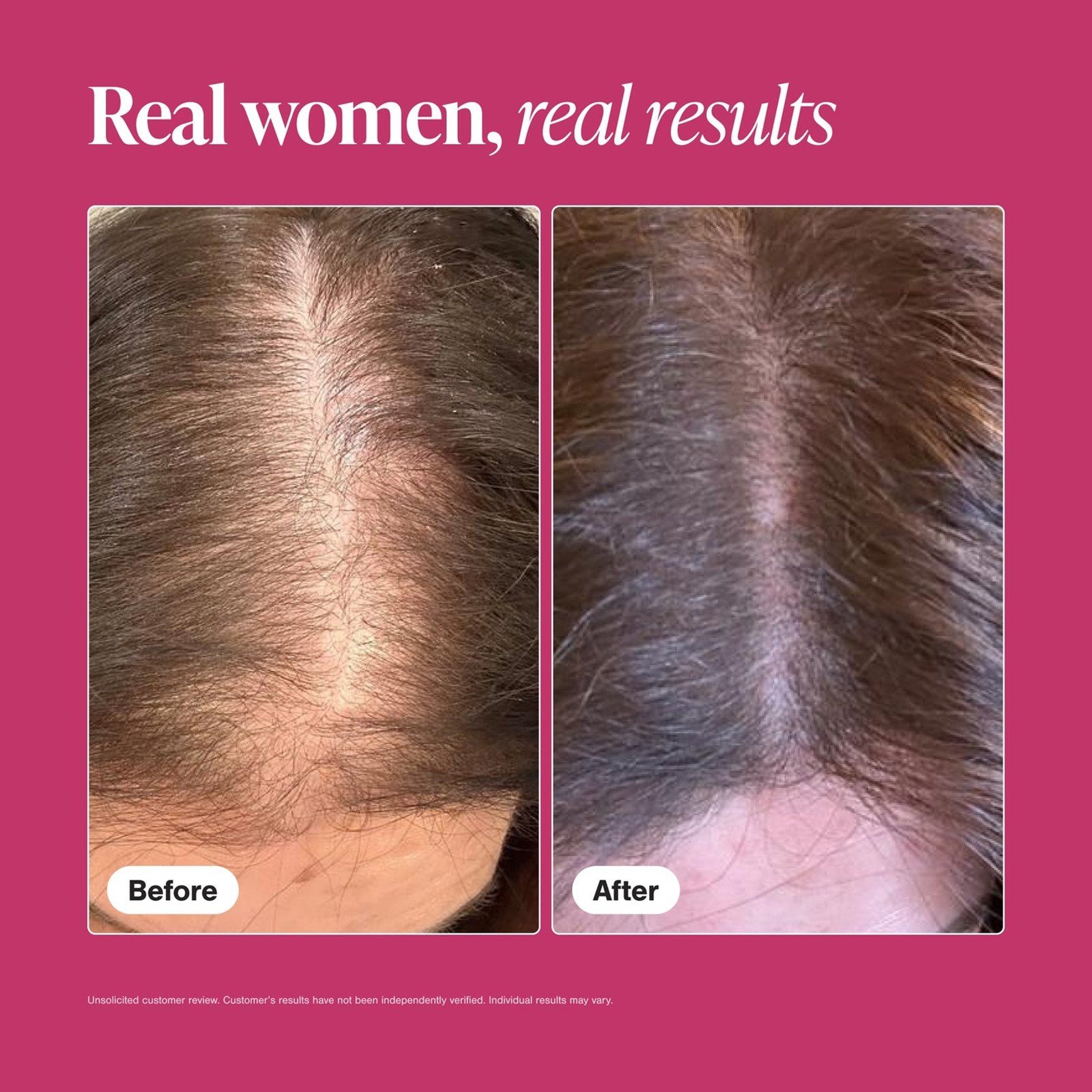 Viviscal Healthy Hair Vitamins Supplement Tablets Hair Loss x60
