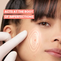 Avène Cleanance Comedomed+ Cuidado Intensivo Antiimperfecciones 30ml