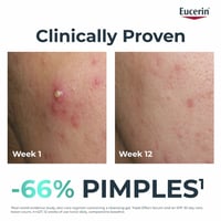 Eucerin DERMOPURE Oil Control Sérum Triple Efecto Piel Propensa al Acné 40ml