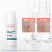 Avène Cleanance Comedomed+ Anti-Imperfections Intensive Anti-Blemish Care 30ml