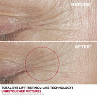 Clarins Concentrado Lifting Total para Ojos