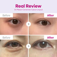 Dr.Melaxin أمبولة الكالسيوم المكثفة سيمنريت بلس 30ml