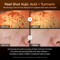 Dr.Melaxin Peel Shot Exfoliating Kojic Acid Turmeric Serum 80ml