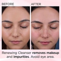 Elizabeth Arden Ceramide Skin Renewing Cleanser 125ml (4.2floz)