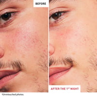 Erborian Skin Therapy Multi-Perfecting Night Oil 30ml (1floz)