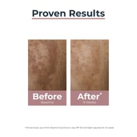 Eucerin Anti-Pigment Dual Serum Dark Spots 30ml