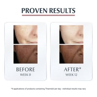 Eucerin Anti-Pigment Corretor Localizado Manchas Escuras 5ml