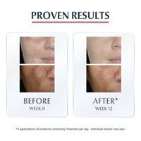 Eucerin Anti-Pigment Corretor Localizado Manchas Escuras 5ml