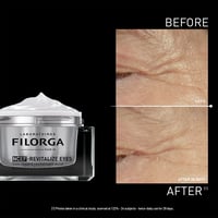 Filorga NCEF-Revitalize Eyes Brightening Eye Cream 15ml (0.5floz)