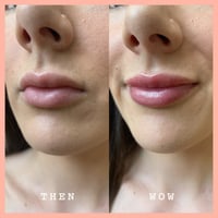 Frank Body Tinta Labbra: Cherry Bomb 15ml