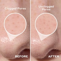 Mario Badescu 2-In-1 Deep Cleansing Pore Strip x6