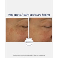 NeoStrata Skin Active Firming Potent Retinol Complex 30ml