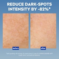 Nivea Luminous 630 Anti-Dark Spots Advanced Serum 30ml