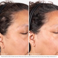 Obagi Nu-Cil BioStim Scalp Serum 60ml