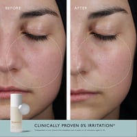 Omorovicza حليب الأحماض 100ml
