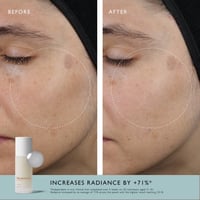 Omorovicza حليب الأحماض 100ml